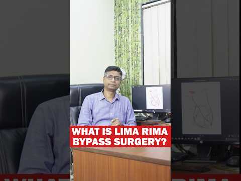 Understanding Cardiac Surgery